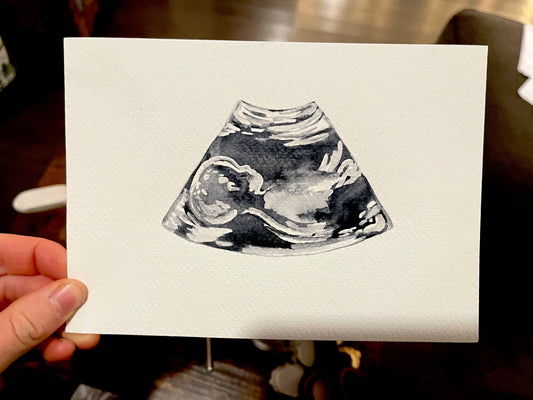Custom Ultrasound Paintings