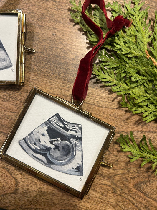 Custom Ultrasound Ornaments